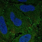 Immunofluorescent staining of human cell line HeLa shows localization to plasma membrane.