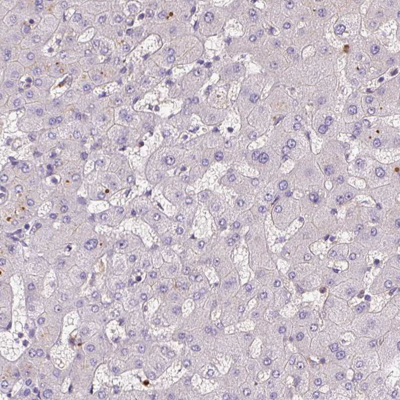 Anti-KIFC1 Antibody