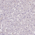 Anti-KIFC1 Antibody