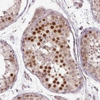 Immunohistochemical staining of human testis shows strong nuclear positivity in cells in seminiferous ducts.