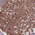 Anti-KIFC1 Antibody