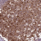 Immunohistochemical staining of human tonsil shows moderate nuclear positivity in germinal center cells.