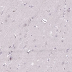 Immunohistochemical staining of human cerebral cortex shows no positivity in neurons as expected.