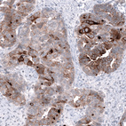 Anti-WFDC2 Antibody