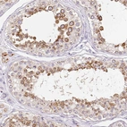 Immunohistochemical staining of human testis shows moderate granular cytoplasmic positivity in cells in seminiferous ducts.