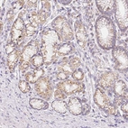 Immunohistochemical staining of human stomach shows moderate cytoplasmic positivity in glandular cells.