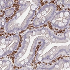 Immunohistochemical staining of human small intestine shows strong cytoplasmic positivity in lymphoid cells.