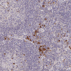 Anti-MEIS1 Antibody