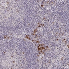 Immunohistochemical staining of human lymph node shows strong cytoplasmic positivity in a subset of non-germinal center cells.