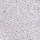 Immunohistochemical staining of human liver shows no positivity in hepatocytes as expected.