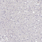 Anti-MEIS1 Antibody