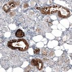 Anti-WFDC2 Antibody