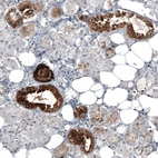 Immunohistochemical staining of human salivary gland shows strong cytoplasmic positivity in interlobular ducts.