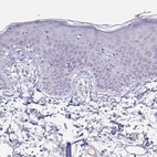 Immunohistochemical staining of human skin shows low expression as expected.