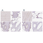 Anti-HEXB Antibody