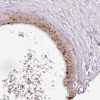 Immunohistochemical staining of human epididymis shows strong granular cytoplasmic positivity in glandular cells.