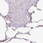Immunohistochemical staining of human lung shows strong granular cytoplasmic positivity in macrophages.