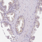 Immunohistochemical staining of human prostate shows strong granular cytoplasmic positivity in glandular cells.