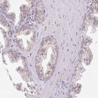 Immunohistochemical staining of human prostate shows strong granular cytoplasmic positivity in glandular cells.