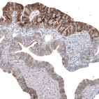 Immunohistochemical staining of human fallopian tube shows strong cytoplasmic positivity in glandular cells.