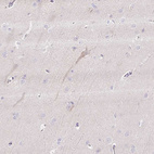 Immunohistochemical staining of human cerebral cortex shows weak cytoplasmic positivity in neuronal cells.