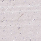 Immunohistochemical staining of human cerebral cortex shows weak cytoplasmic positivity in neuronal cells.