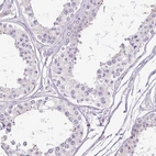 Immunohistochemical staining of human testis shows no positivity in cells in seminiferous ducts.