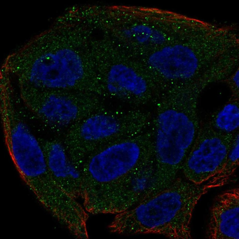 Anti-UGT1A6 Antibody
