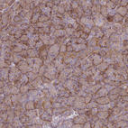 Anti-TNS3 Antibody