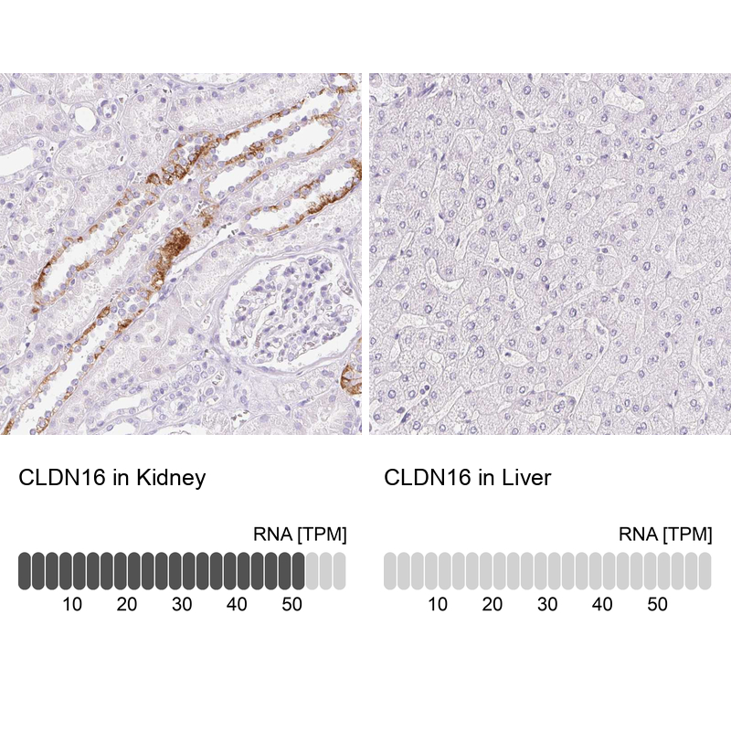 Anti-CLDN16 Antibody