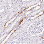 Immunohistochemical staining of human kidney shows moderate membranous-cytoplasmic positivity in cells in tubules.