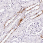 Immunohistochemical staining of human kidney shows moderate membranous-cytoplasmic positivity in cells in tubules.