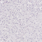 Immunohistochemical staining of human liver shows no positivity in hepatocytes as expected.