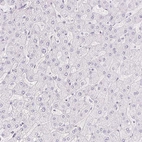 Immunohistochemical staining of human liver shows no positivity in hepatocytes as expected.