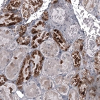 Immunohistochemical staining of human kidney shows strong cytoplasmic positivity in a subset cells in tubules.
