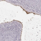 Immunohistochemical staining of human epididymis shows high expression.