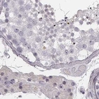 Immunohistochemical staining of human testis using Anti-SMIM24 antibody HPA056027.