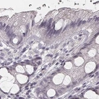 Immunohistochemical staining of human colon using Anti-SMIM24 antibody HPA056027.