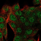 Anti-SMIM24 Antibody