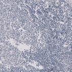 Immunohistochemical staining of human tonsil shows no positivity in non-germinal center cells as expected.