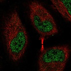 Anti-EEF2K Antibody
