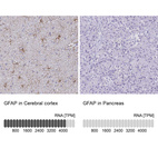 Anti-GFAP Antibody