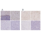 Immunohistochemical staining of human cerebellum, cerebral cortex, liver and pancreas using Anti-GFAP antibody HPA056030 (A) shows similar protein distribution across tissues to independent antibody HPA063513 (B).