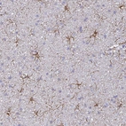 Immunohistochemical staining of human cerebral cortex shows positivity in astrocytes.