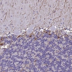 Immunohistochemical staining of human cerebellum shows positivity in astrocytes.