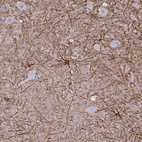 Immunohistochemical staining of human hippocampus shows positivity in astrocytes.