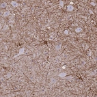 Immunohistochemical staining of human hippocampus shows positivity in astrocytes.