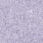 Immunohistochemical staining of human pancreas shows no positivity as expected.