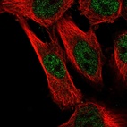 Immunofluorescent staining of human cell line U-251 MG shows localization to nucleoplasm.
