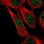 Immunofluorescent staining of human cell line U-251 MG shows localization to nucleoplasm.